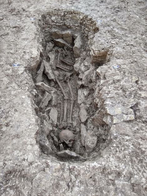 Un esqueleto con la cabeza en los pies.