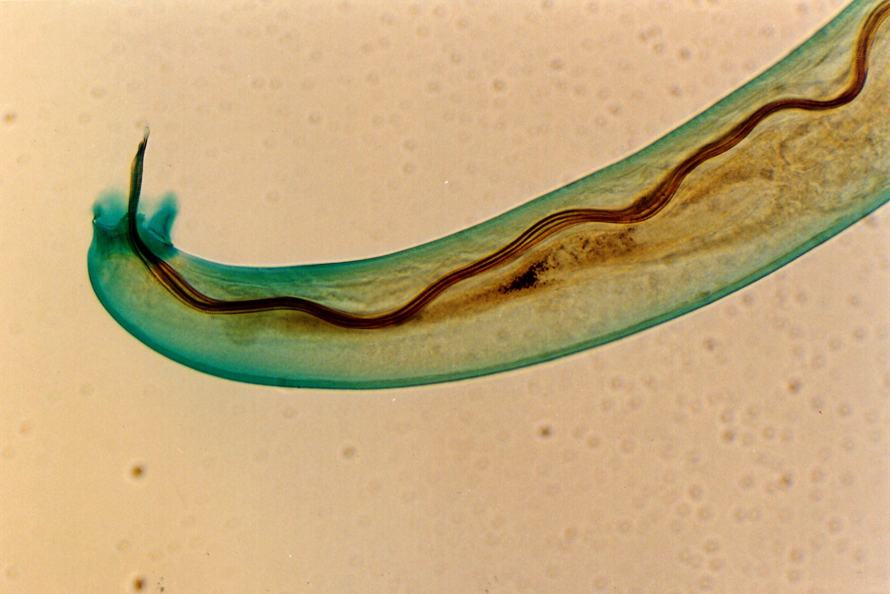 Image: Angiostrongylus cantonensis