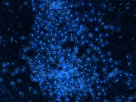 Células de Noctiluca scintillans brillando bajo el microscopio. Imagen: Sheng-Fang Tsai, National Taiwan Ocean University