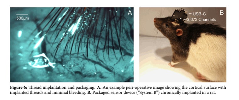 Screenshot: Neuralink