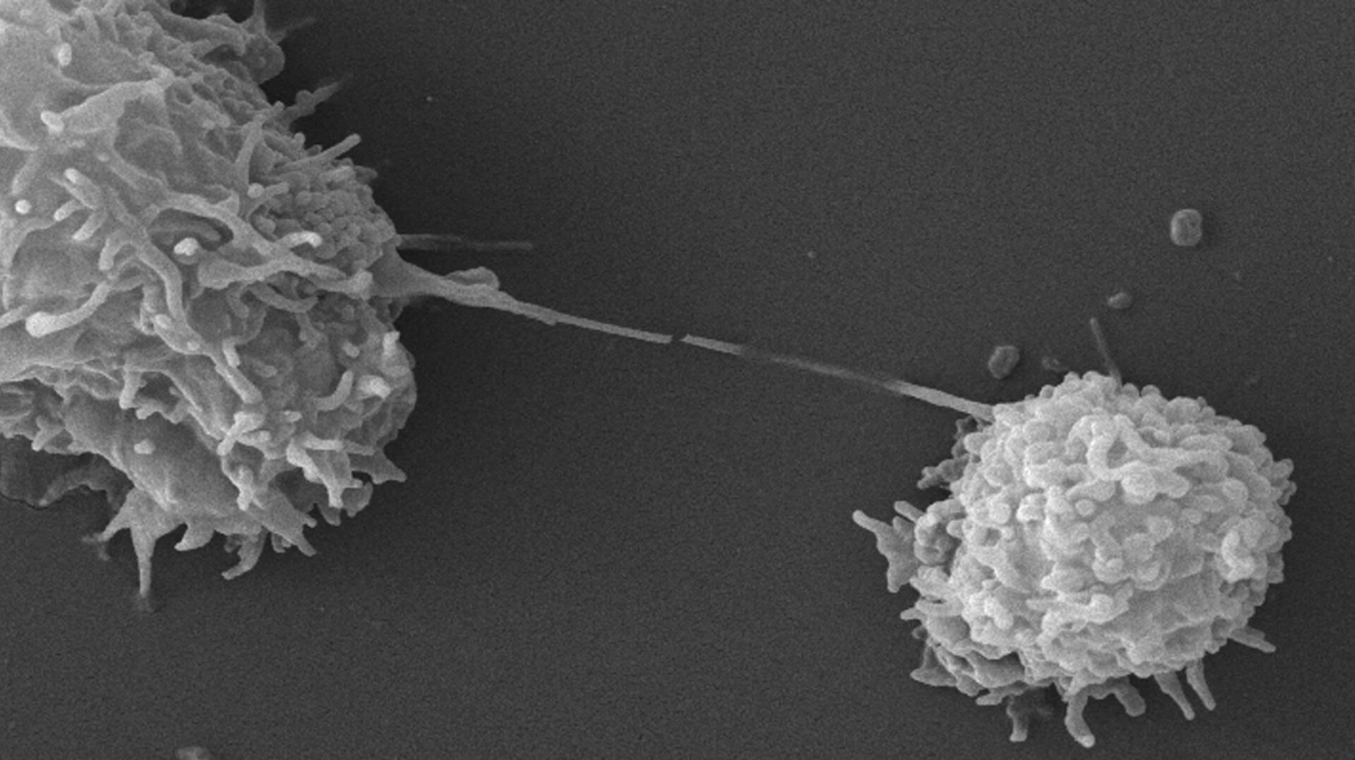 Dos Acanthamoeba vistas bajo el microscopio