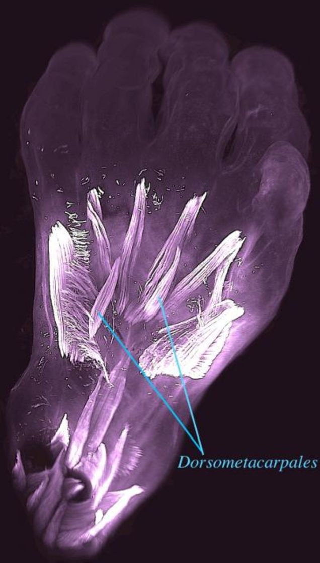 Image: La vista dorsal de la mano izquierda de un embrión humano de 10 semanas de edad, con los dorsometacarpales resaltados