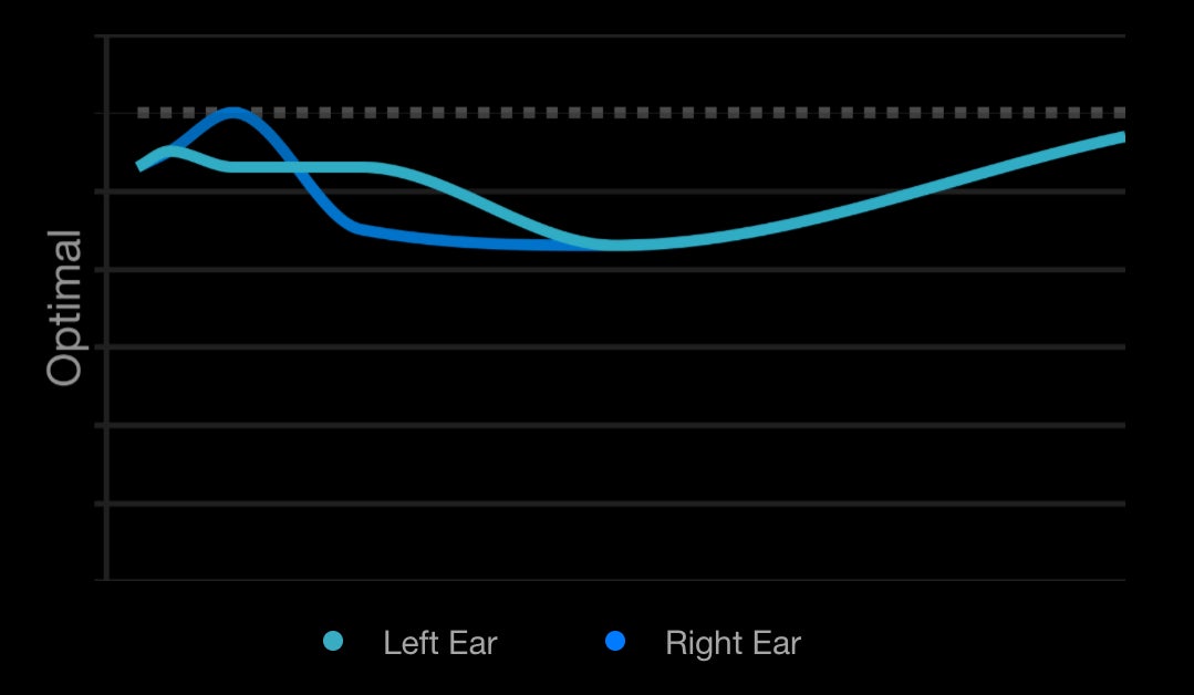 Graphic: Parece que tenía un problema en el oído derecho...