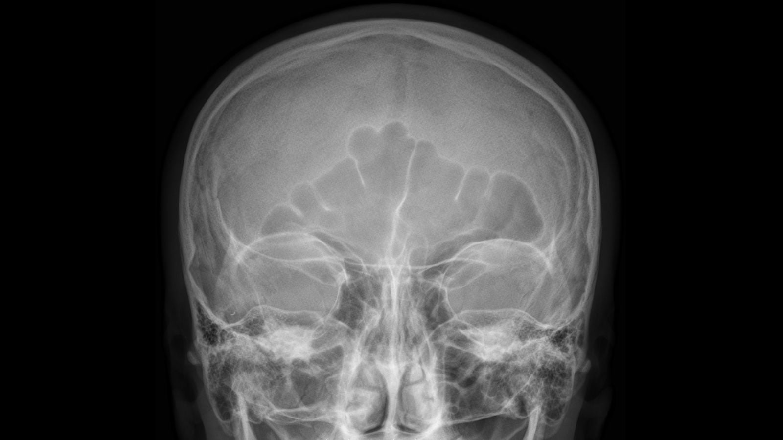 Image: Hellerhoff/Wikimedia Commons