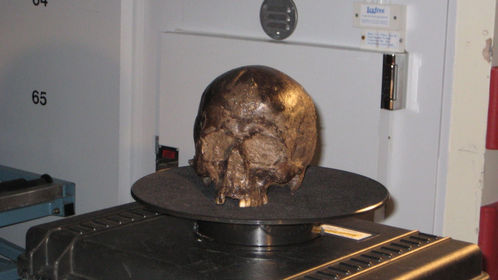Image: El cráneo dentro del cual se encontró el cerebro