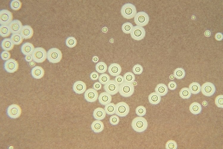 Image: Fotomicrografía que muestra los Cryptococcus neoformans