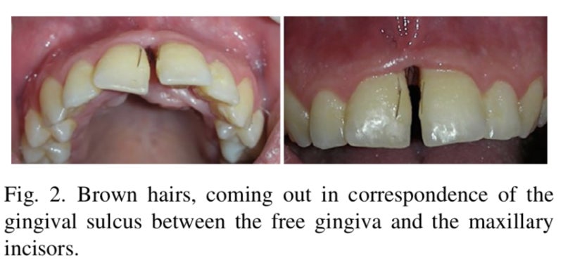 Image: