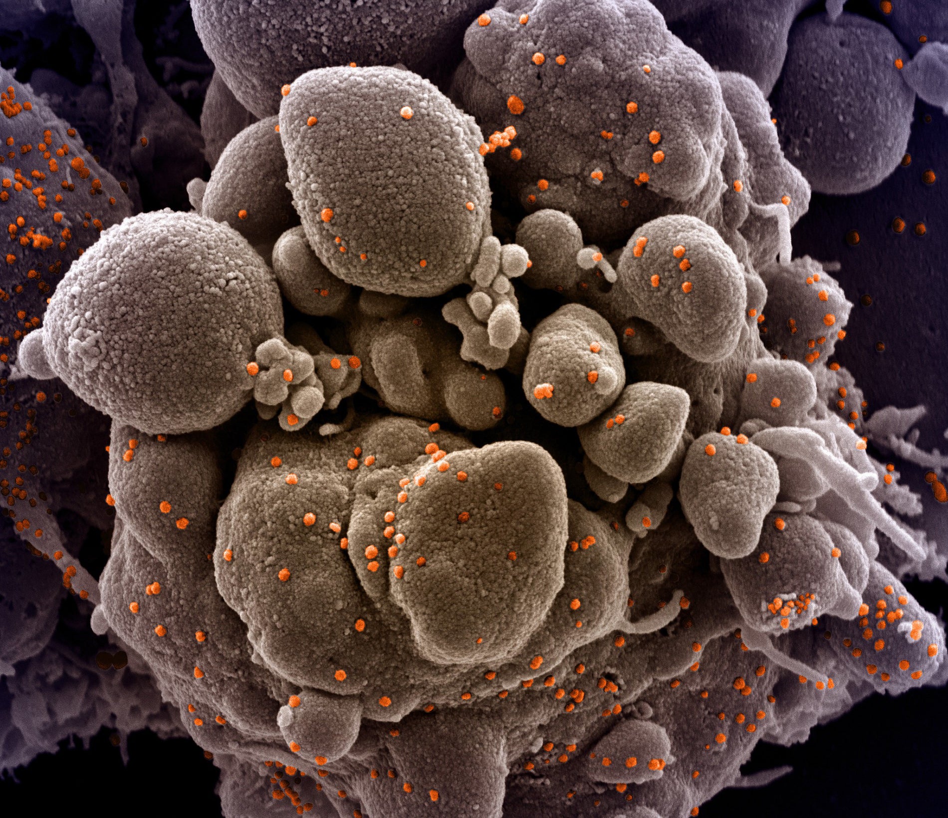 Image: NIAID / Flickr