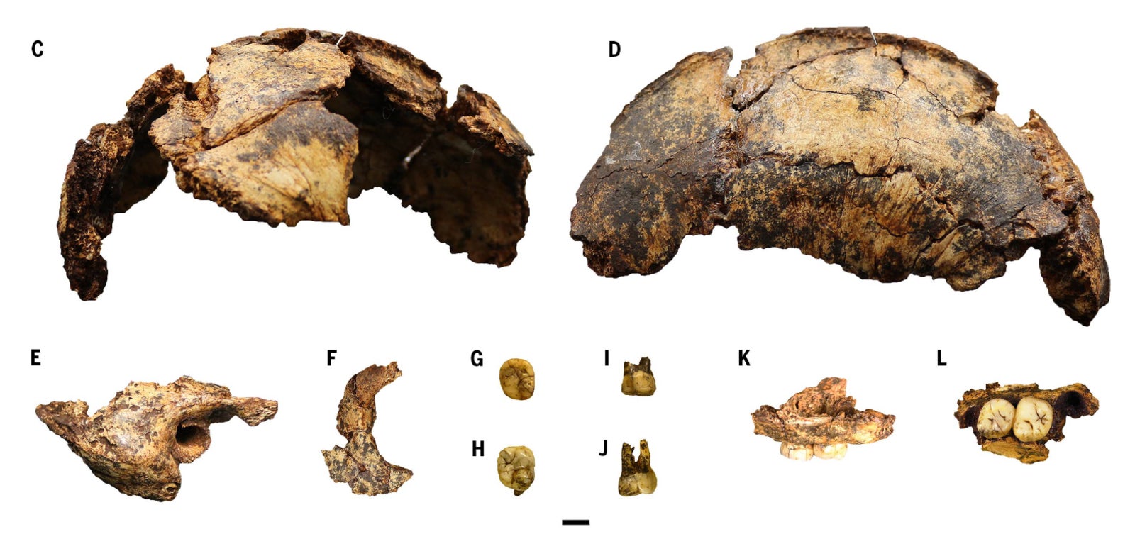 Restos del DNH 152, el fragmento de cráneo encontrado, junto a algunas piezas dentales. Imagen: A. I. R. Herries et al., 2020/Science