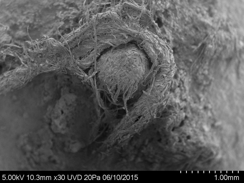 Image: Imagen microscópica del cordón neandertal
