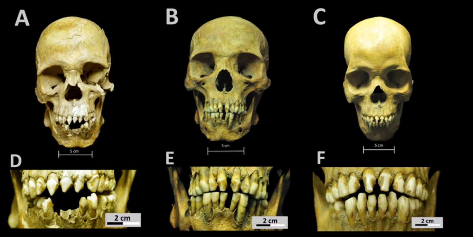 Image: Cráneos y patrones de decoración dental observados en los restos esqueléticos.
