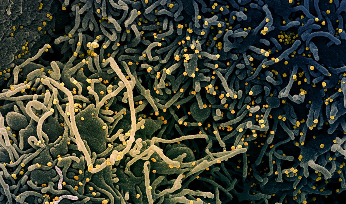 Photo: NIAID / Flickr