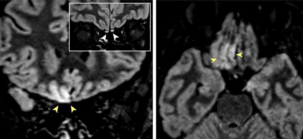 Image: JAMA Neurology