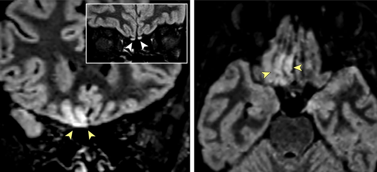 Image: JAMA Neurology