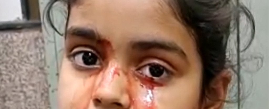 Image: La pequeña del extraño caso