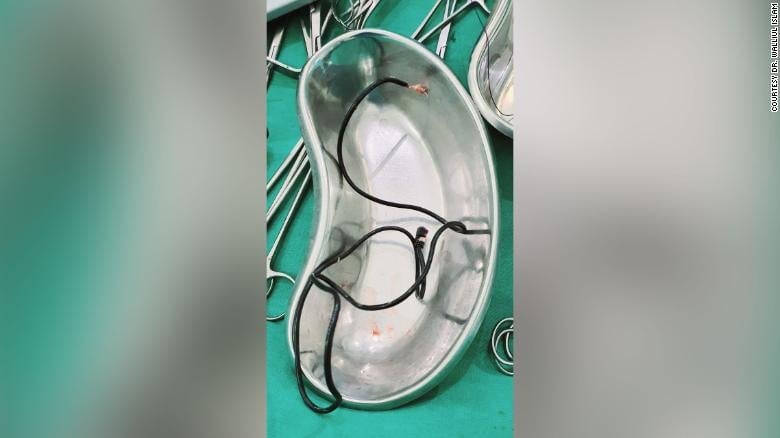 Image: Los”auriculares” encontrados