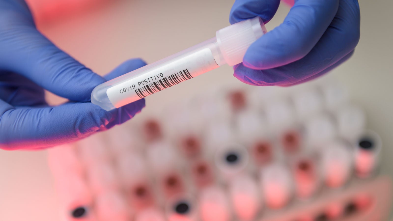 Photo:  Pedro Vilela