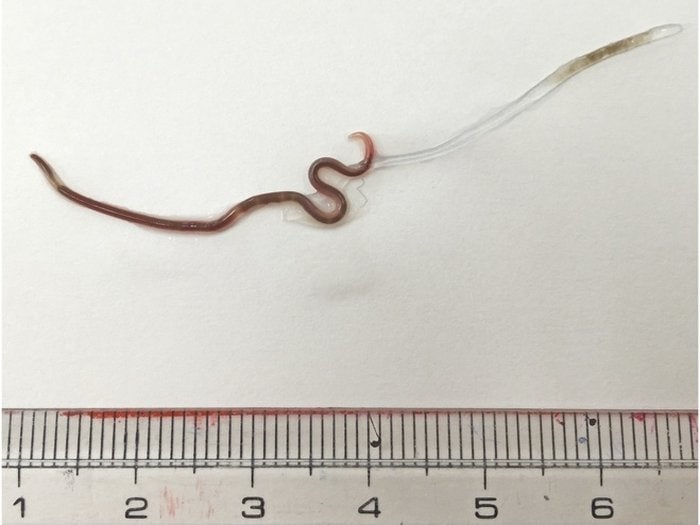 Image: Fukui et al., Am. J. Trop. Med. Hyg., 2020
