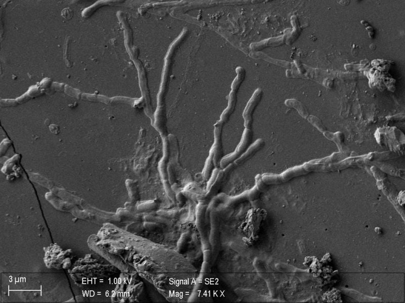 Una imagen de microscopio electrónico de barrido que muestra lo que parecen ser axones parecidos a gusanos que sobresalen de las células neuronales.