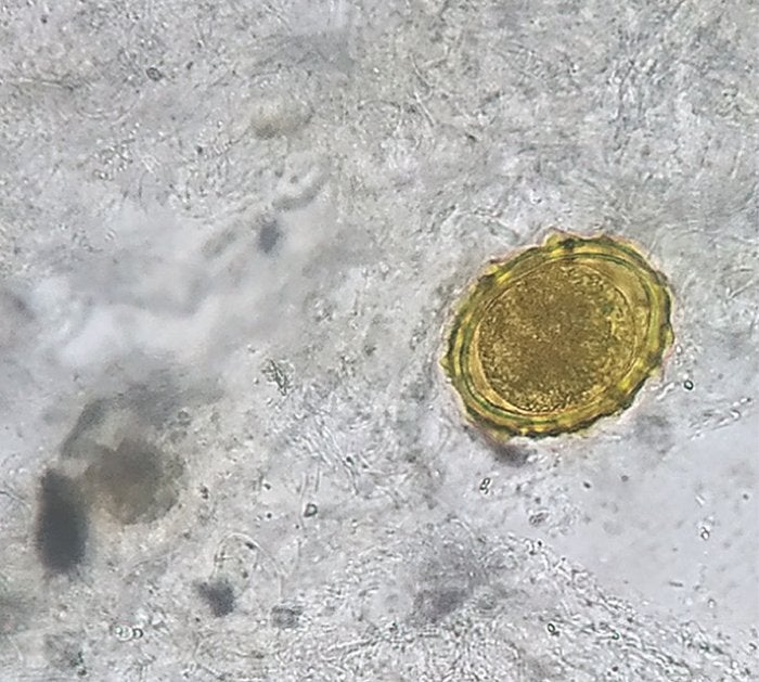 Image: Chaurasia & Bhoi, NEJM, 2020