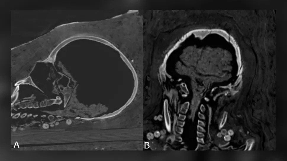 Image: Zesch et al., PLOS One, 2020