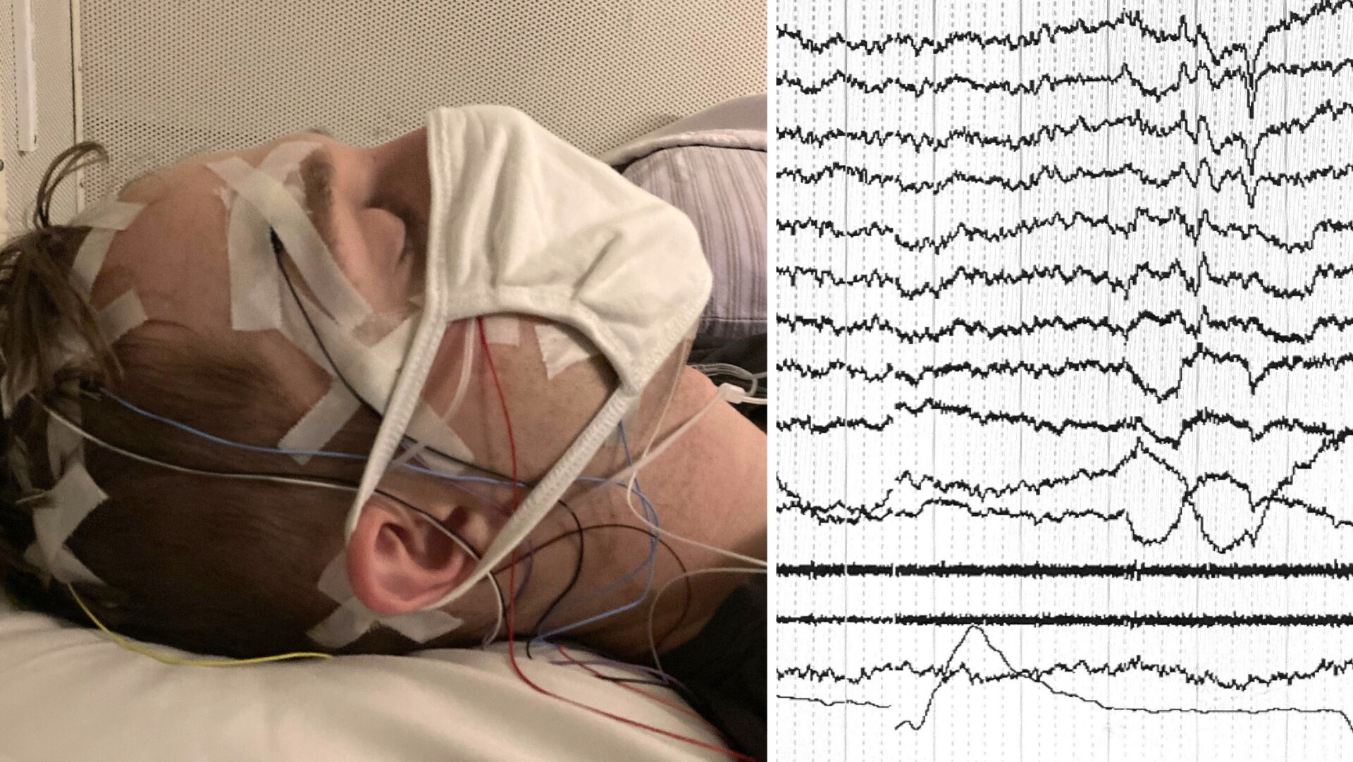 Las señales eléctricas del cerebro de una persona dormida se muestran en el monitor.