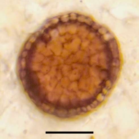 La diferencia en los tipos de células es visible al microscopio.