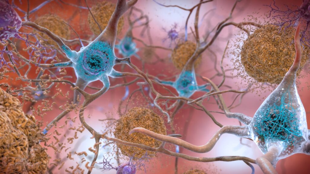 Image: NIH Image Gallery/Wikimedia Commons
