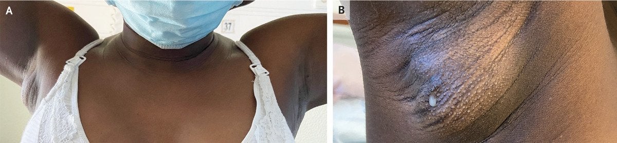 Image: The New England Journal of Medicine