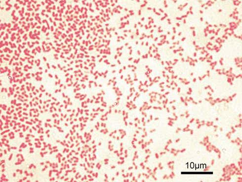 Bacteria P. aeruginosa teñida de rojo bajo un microscopio