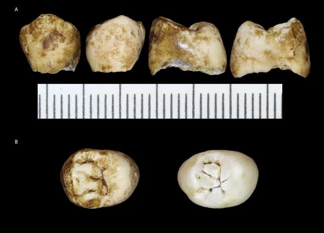 Múltiples vistas de un molar perteneciente al cráneo