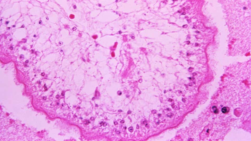 Image: George R. Healy (CDC)