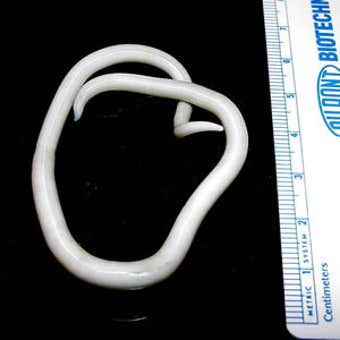 La tenia Ascaris lumbricoides