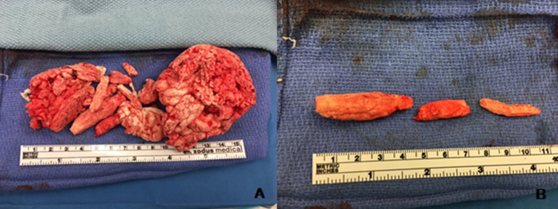 Photo: RosaPark, Susan M.MacDonald/Urology Case Reports