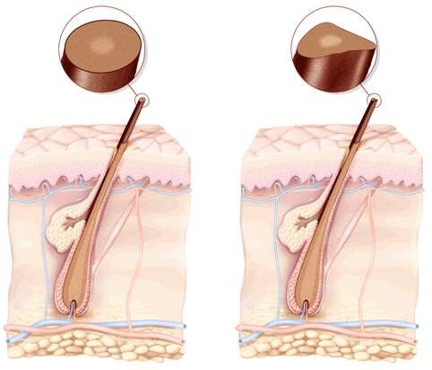 Image: Wikimedia Commons/CC BY 4.0