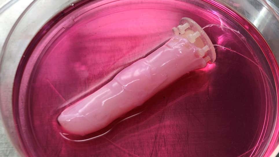 En el medio de cultivo, un dedo robótico cubierto con piel humana se autocura después de que los investigadores cubrieran su herida con una lámina de colágeno.