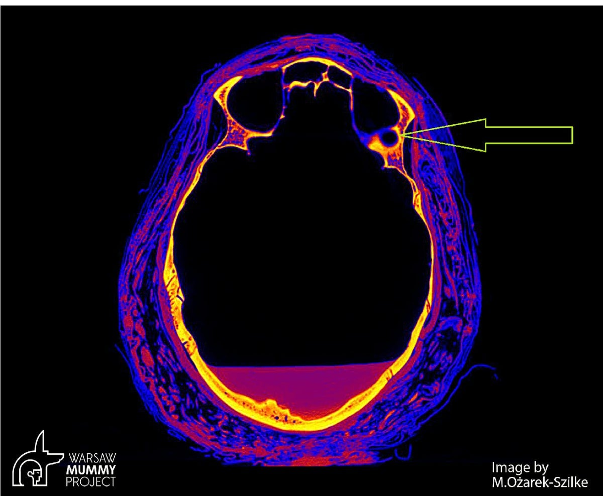 Image: Aleksander Leydo/Warsaw Mummy Project