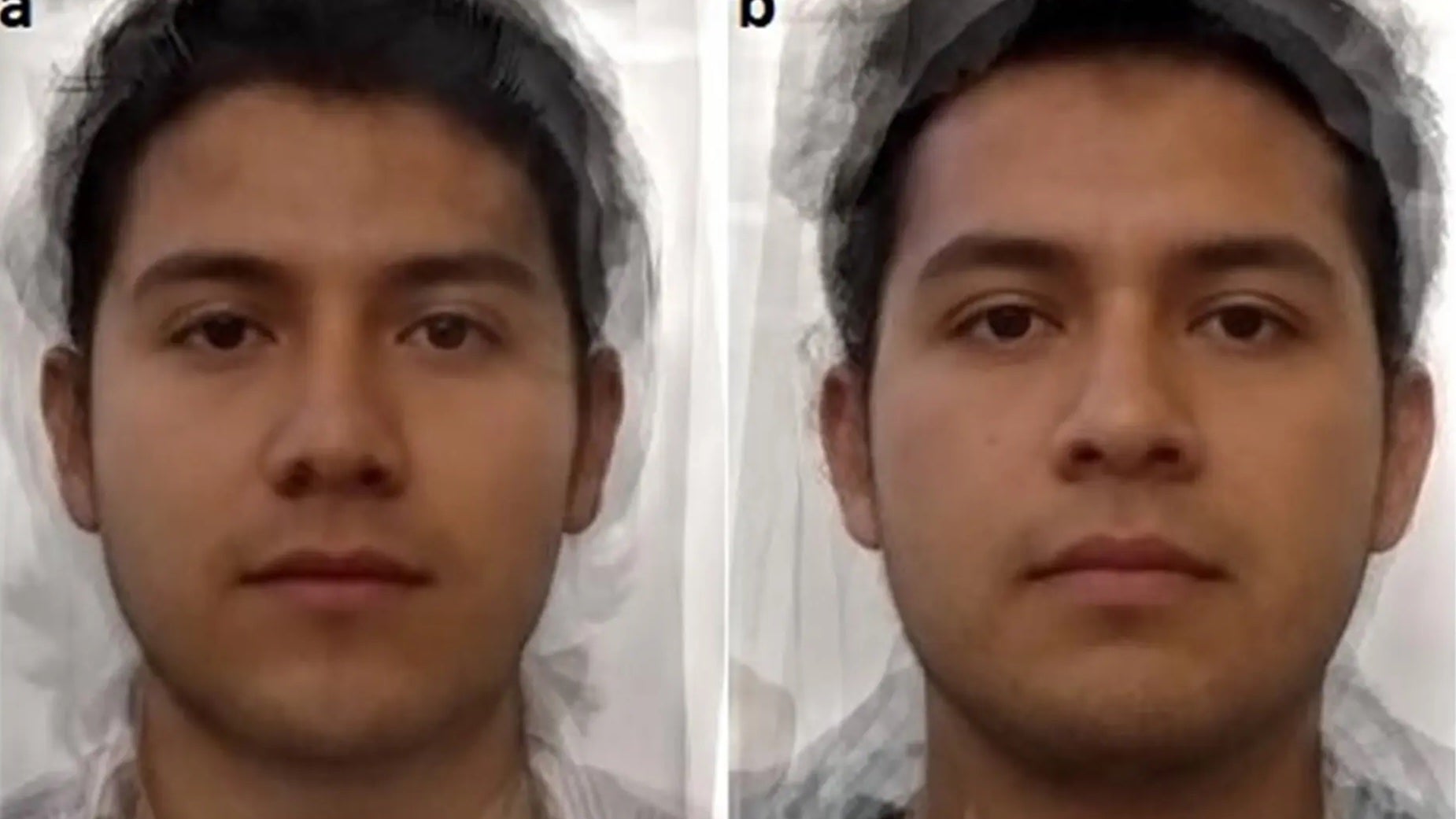 A la izquierda, hombres infectados con T. Gondii y a la derecha, hombres no infectados