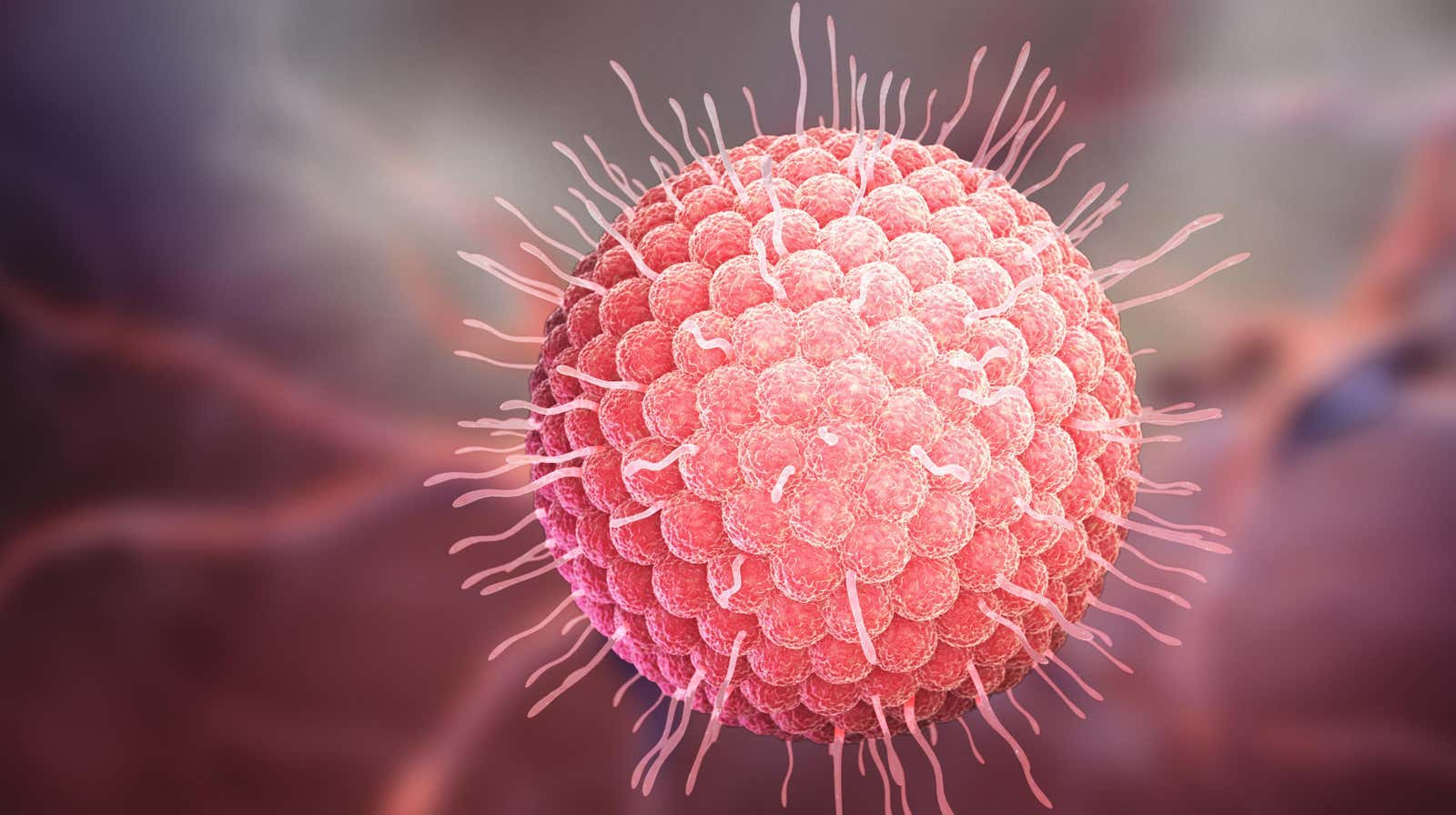 Las imágenes del cerebro mostraron una contracción en el hipocampo, que está involucrado en la memoria, y su líquido cefalorraquídeo insinuó marcadores comunes de esta forma más común de demencia