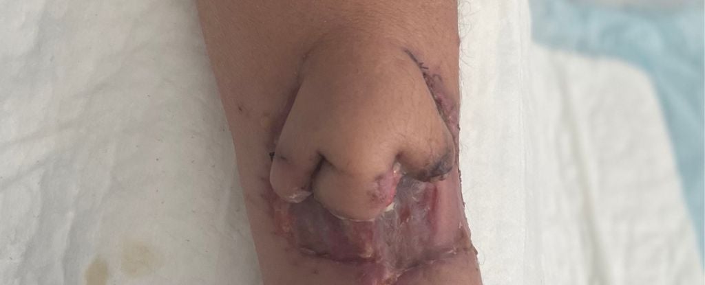 Image: CHU de Toulouse