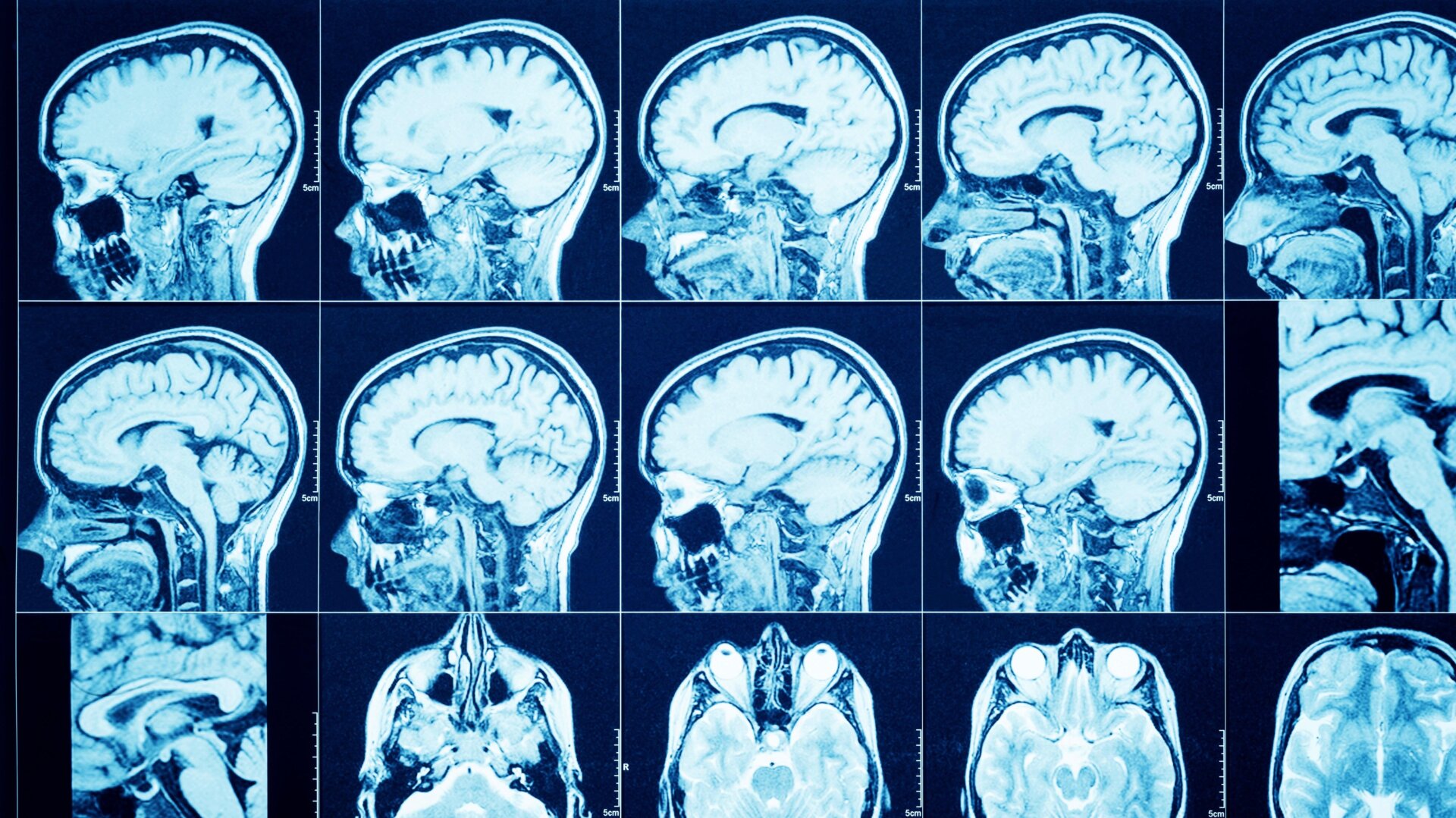 Imágenes genéricas del cerebro
