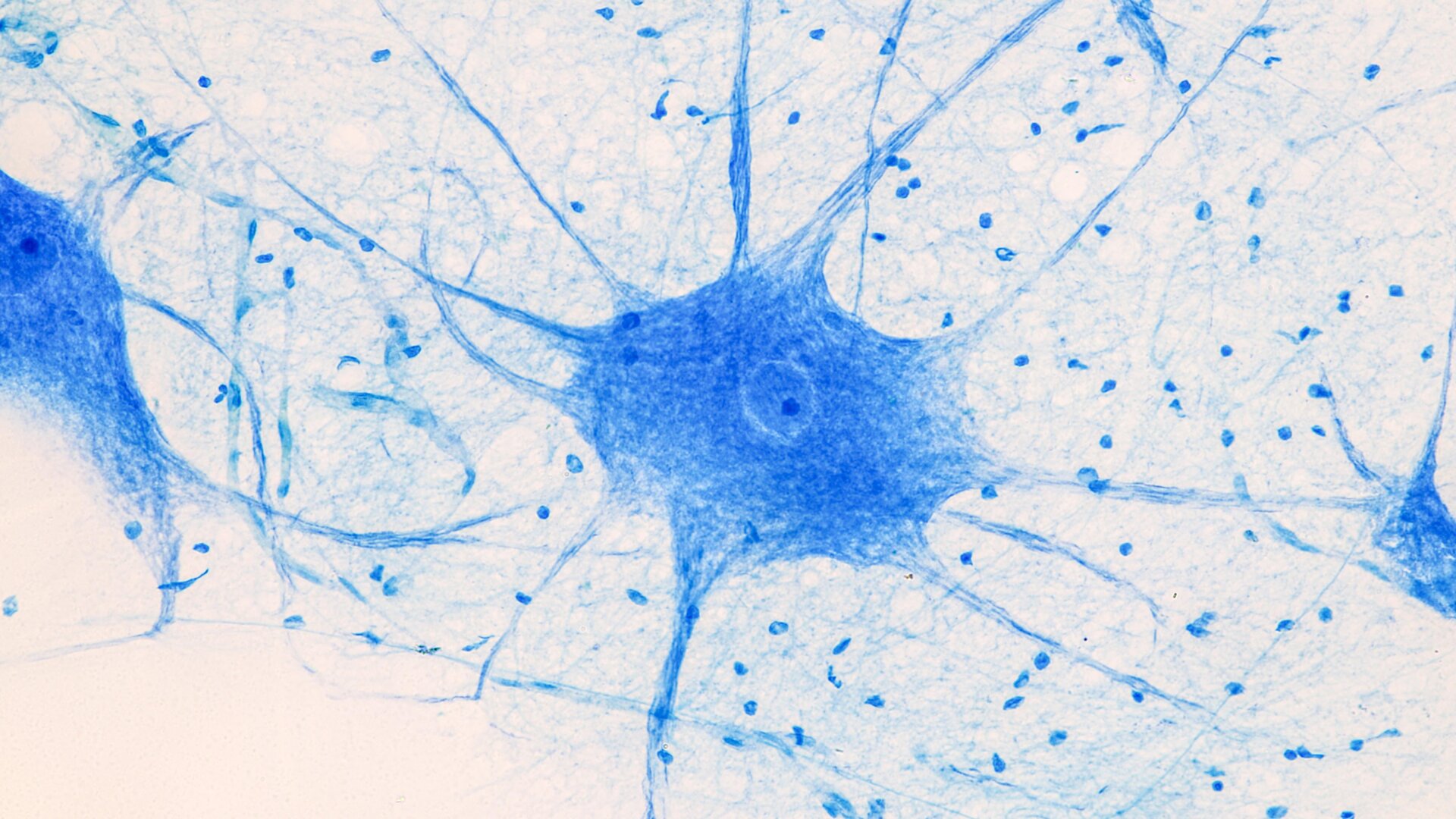 Neuronas motoras bajo un microscopio.