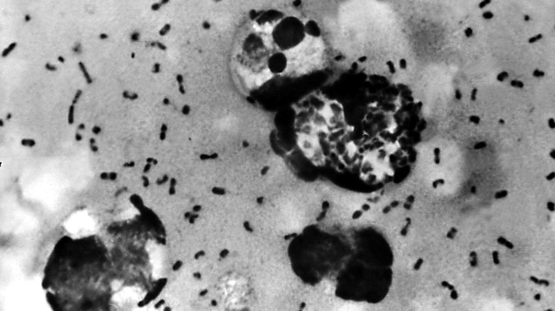 Un frotis de peste bubónica, preparado a partir de una linfa extraída de un ganglio linfático adenopático, o bubón, de un paciente con peste, demuestra la presencia de la bacteria Yersinia pestis que causa la plaga en esta foto sin fecha.