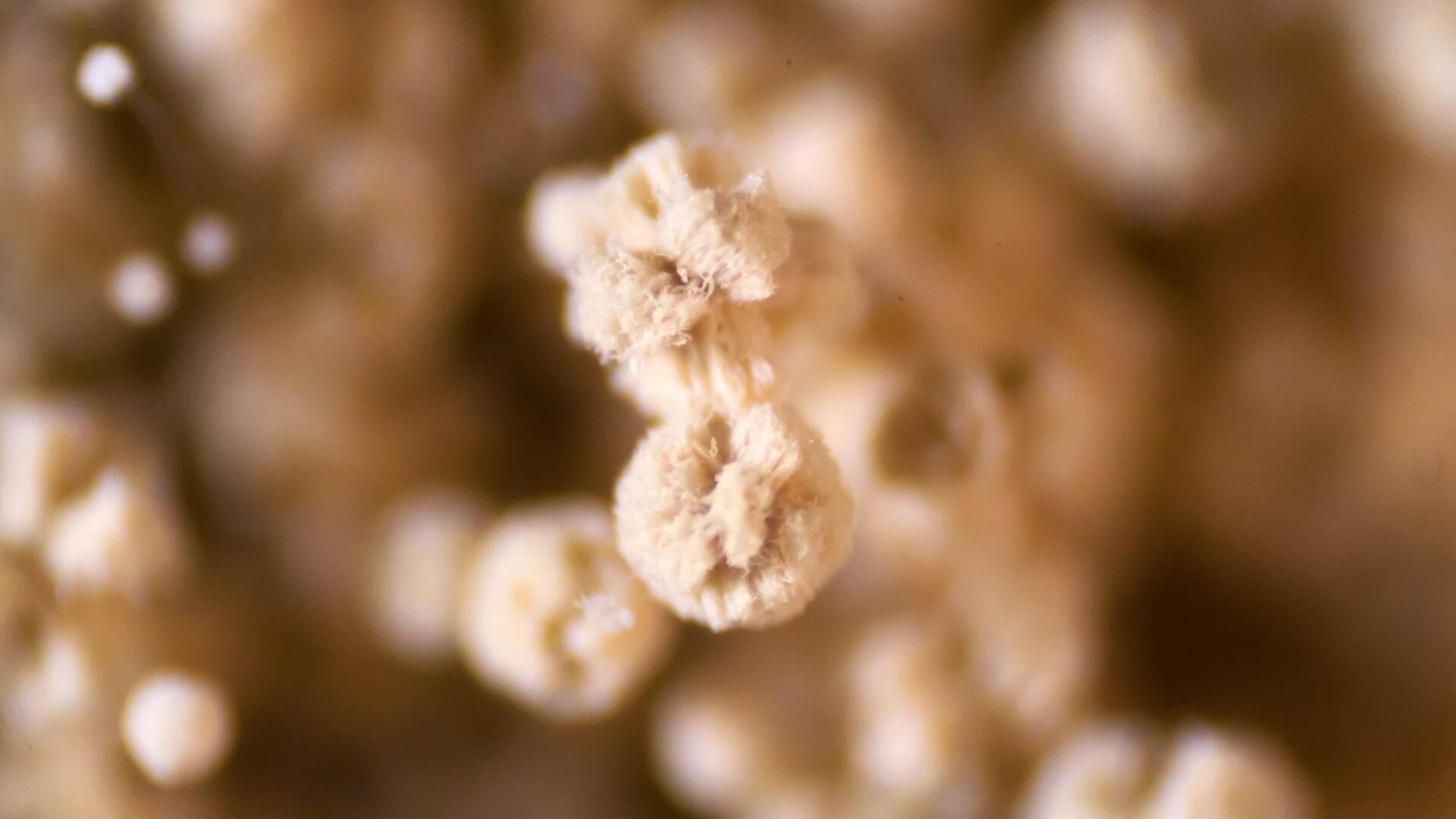 un Aspergilo molde bajo un microscopio.
