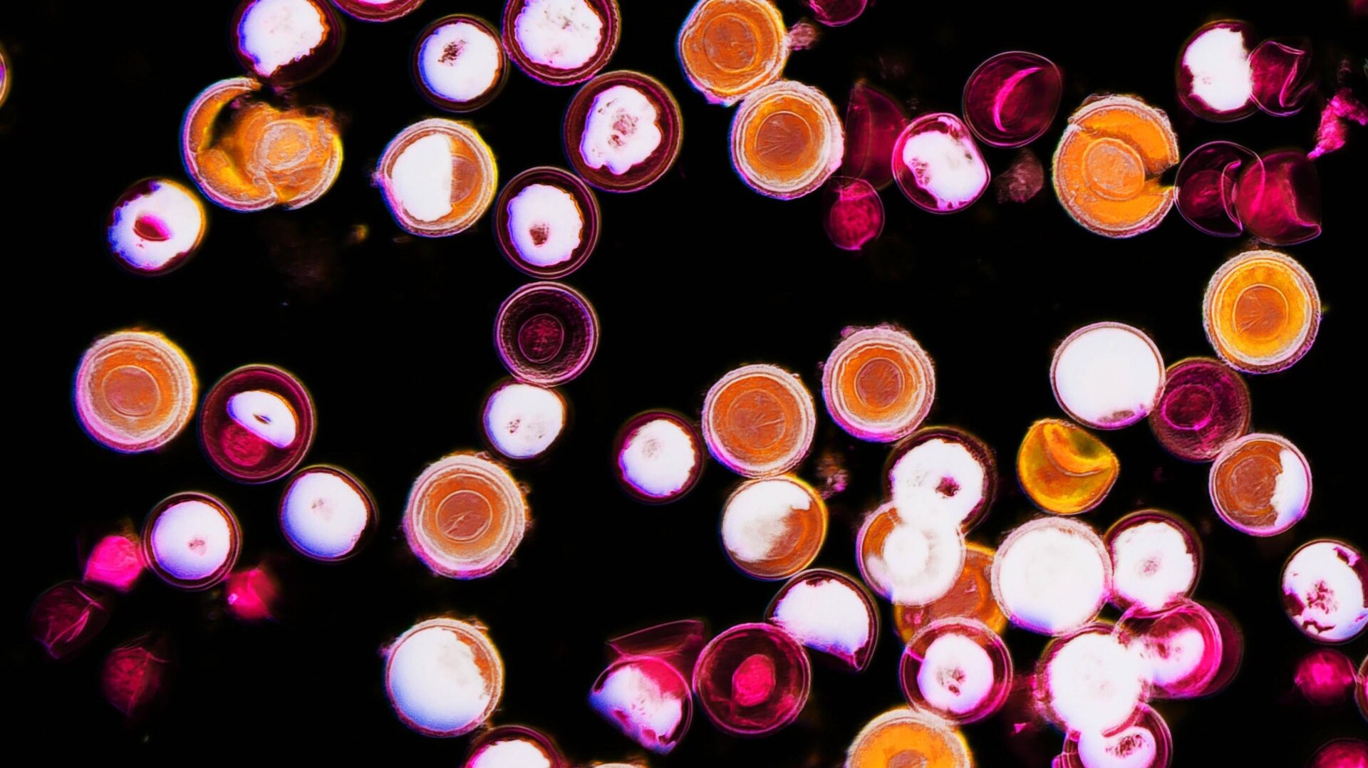 Una imagen de tenia (Tenia) huevos bajo un microscopio mejorado para mostrar su estructura interna.