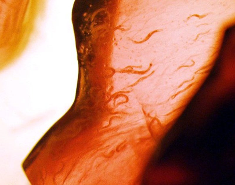 Los nemotodos o gusanos redondos C. elegans sometidos a experimentación en el transbordador espacial. 