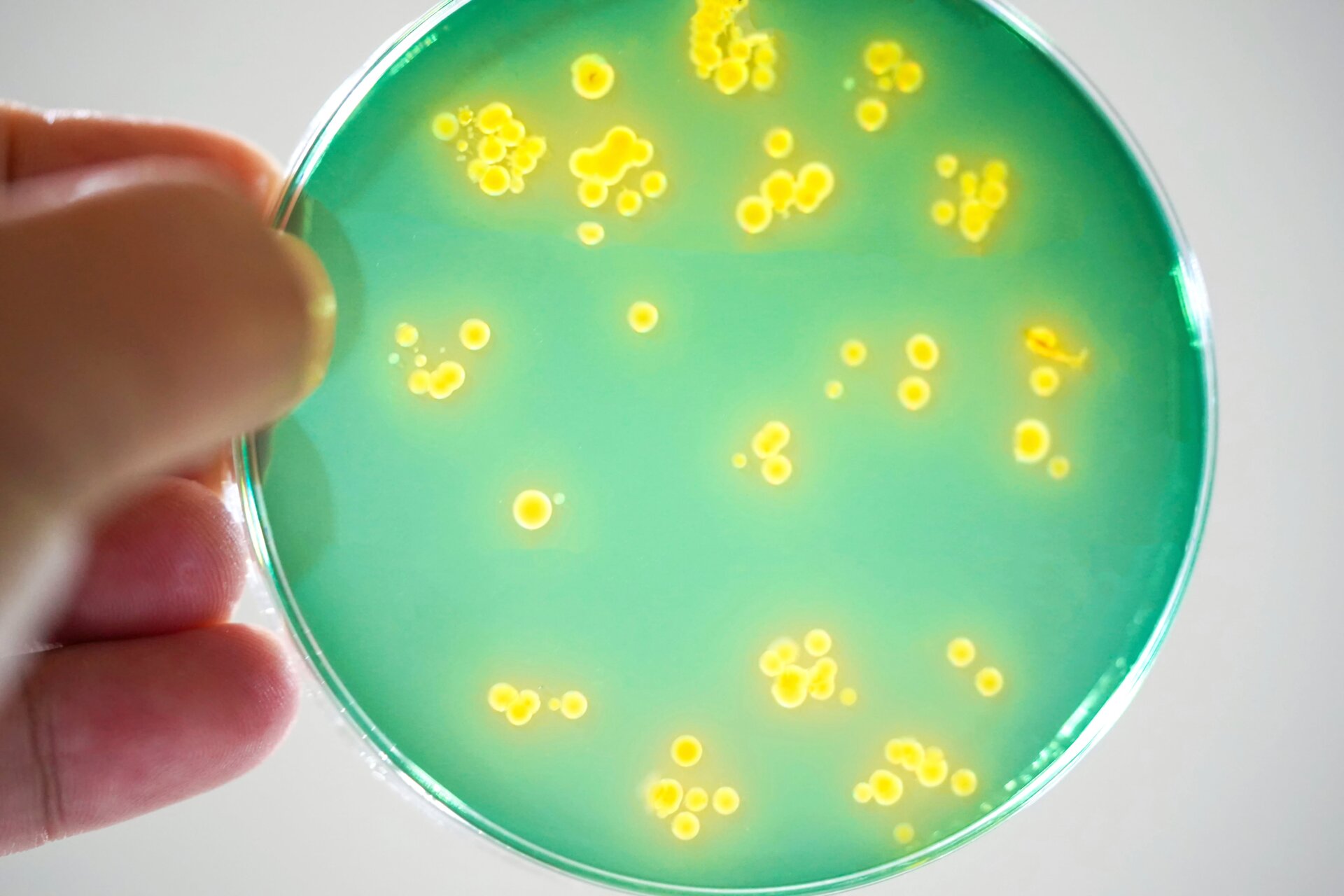 Las bacterias vibrio se cultivan en una placa de petri.