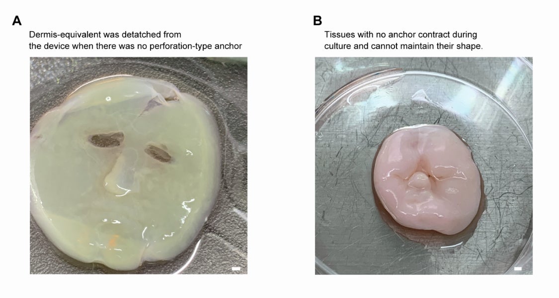 Como se explica en el artículo: “El equivalente de Dermis fabricado en el dispositivo facial 3D sin anclajes de tipo perforación. (A) En ausencia de perforación -anclajes, el equivalente de dermis se desprende del dispositivo facial al despegar el molde superior. (B) Cultivar equivalentes de dermis que no lo son  asegurados por anclajes de tipo perforación da resulta en la incapacidad de mantener su forma. Barras de escala, (A) 1 mm; (B) 1 mm. ”