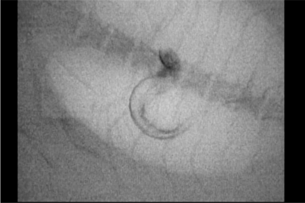 Anguila Japonesa Con Peces