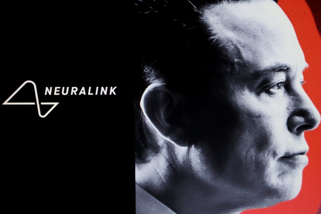 Chip Para La Ceguera De Neuralink